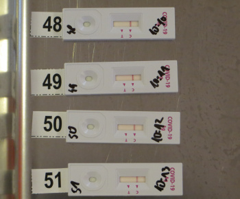 Epidemické testovanie